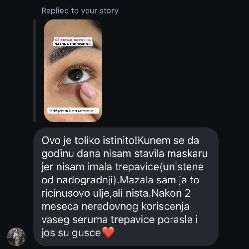 TREPAVICE