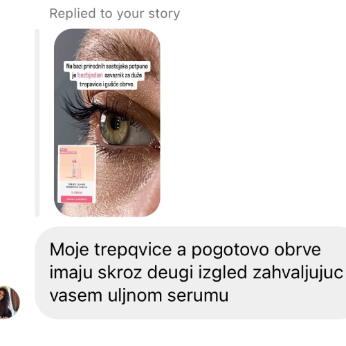 trepuÅ¡ke
