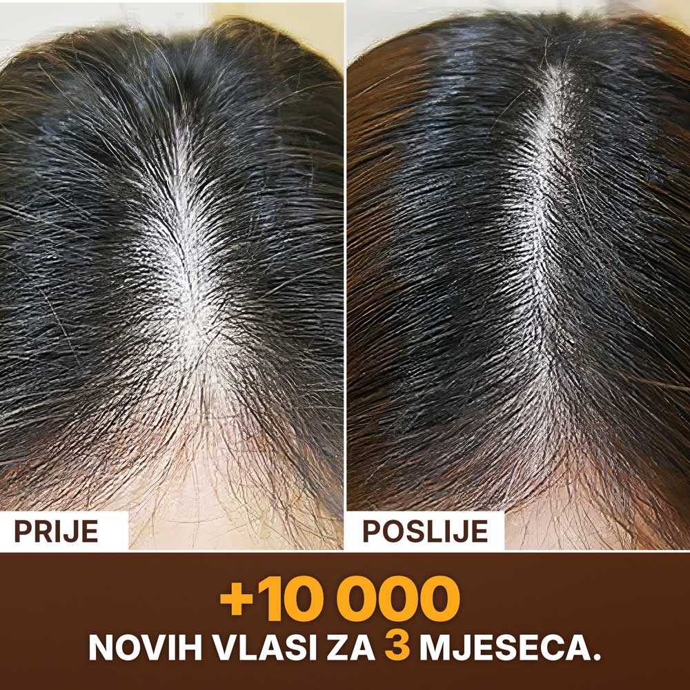 SLAJD-PRIJE-POSLIJE
